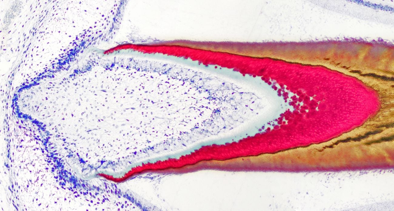 8-Toothformation