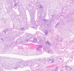 Whole-Slide-Whole-Lung-3-edited