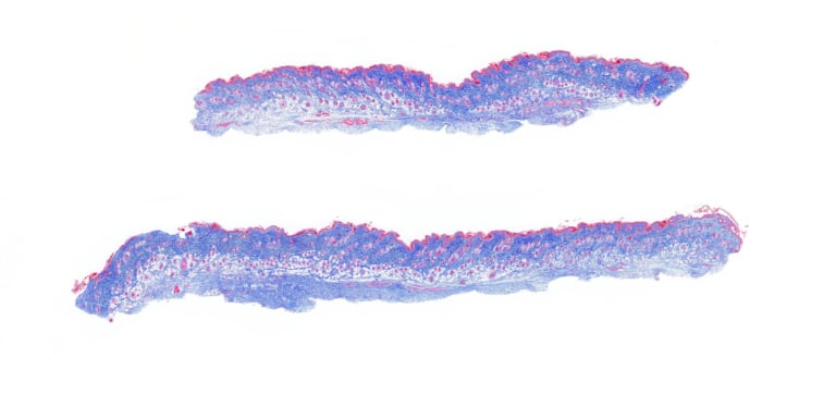 WholeSlide-Skin-Control-Trichrome-scan_edited-768x363