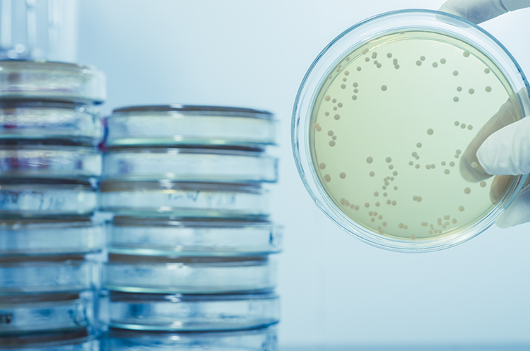 Agar-plate-full-of-micro-bacterias-and-microorganisms