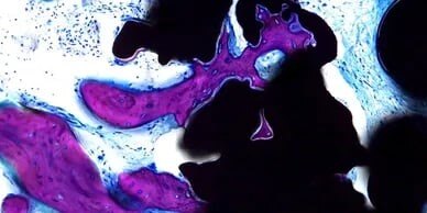 Ground Tissue Section showing bone purple and implant black