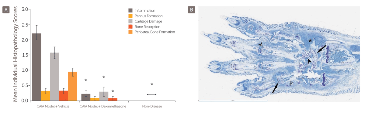 Rheumatoid_Arthritis_CAIA_Histology