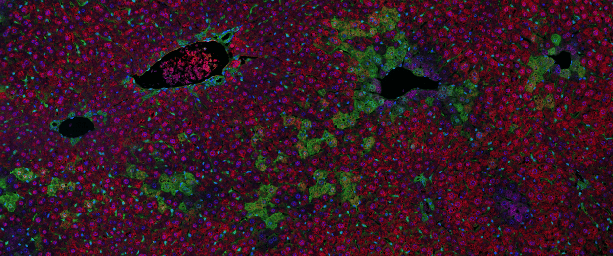 Pathology/Histology 3xIF GFP Liver