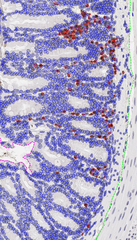 SA-Pathology-Histology-Quantitative-Image-Analysis-MPO-IHC-Colon