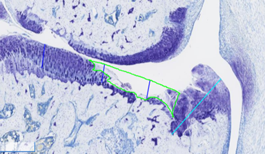 discovery-pathology-1