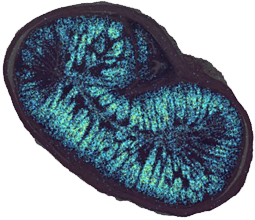 discovery-pathology-18