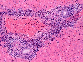 discovery-pathology-2.png