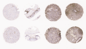 discovery-pathology-5