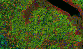 discovery-pathology-7