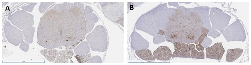 histopathologyical-alanyslics-of-neural-tissue