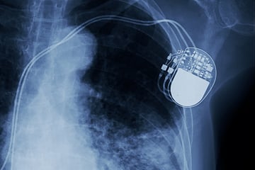 medical-device_pathology-evaluation-of-medical-devices