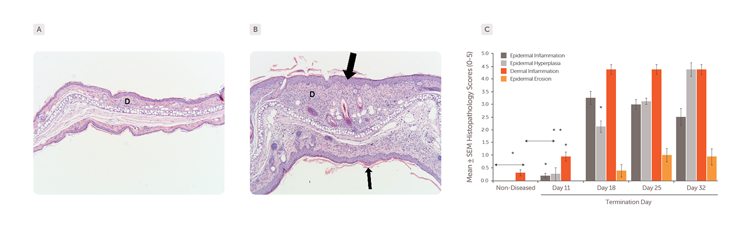 Inflammatory_Skin_Diseases_Webpage_FIGURE_5