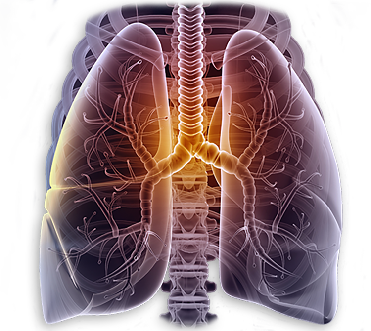 Pulmonary Disease Models