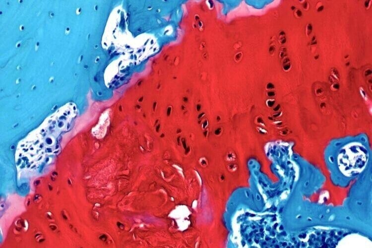 Medical Device and Plastics Histology